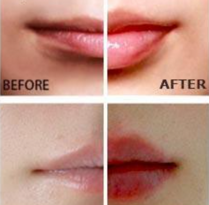 Miracle Lip Plumper — Instant Fuller Lips